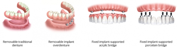 bound brook dentist